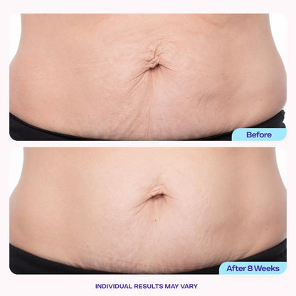 BellySmooth™ Firming Cream